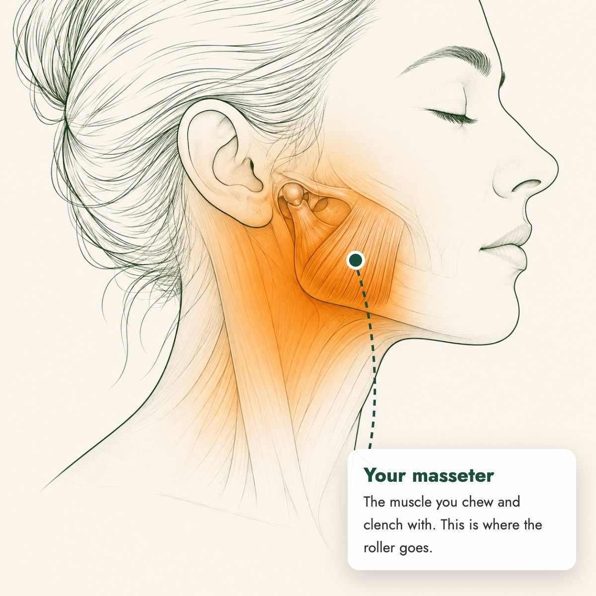 The masseter, the muscle you chew and clench with